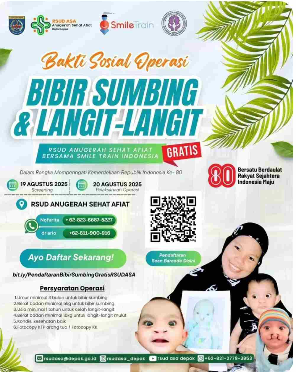 RSUD ASA Depok Gelar Operasi Gratis Bibir Sumbing: Harapan Baru untuk Anak-Anak Indonesia