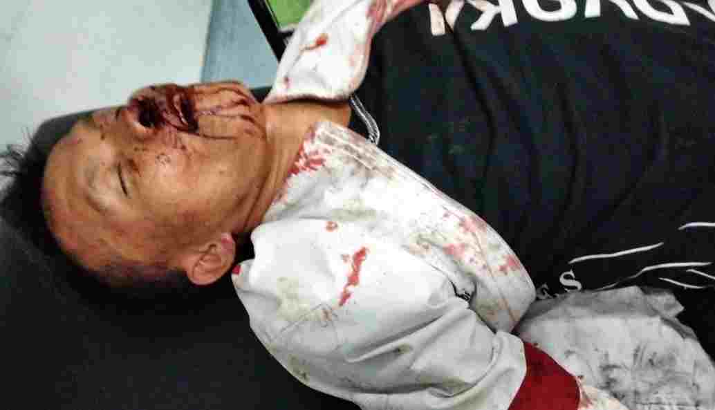 Viral ADVokat Dikeroyok Belasan Orang di Kabupaten Bandung, Law Firm Ratakan & Partners: “Ini Serangan Terhadap Hukum, Harus Diusut Sampai Aktor Intelektual!”